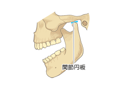 口を開いた骨